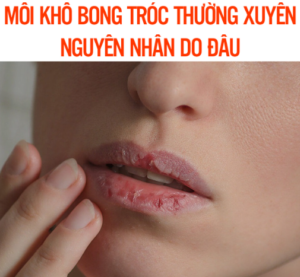 Nguyên nhân dẫn tới việc môi hay bị khô, bong tróc da